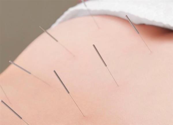 河北省郭氏按摩職業(yè)培訓(xùn)學(xué)校中醫(yī)針灸推拿專(zhuān)業(yè)培訓(xùn)班開(kāi)課了嗎？